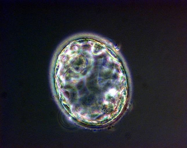 Sommes-nous arrivés à lère des bébés édités ? Une équipe américaine annonce avoir modifié des gènes dembryons humains avec une technologie plus fiable que celle utilisée auparavant. Alors quil nest pas à ce stade question dune utilisation en dehors des laboratoires, cette annonce fait réagir et suscite de vifs débats.